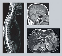 Imaging of the brain and the spinal cord